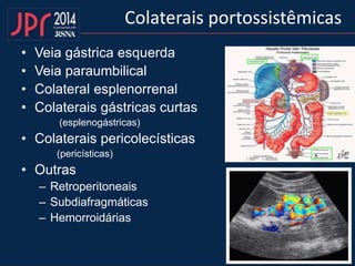 • Veia gástrica esquerda
• Veia paraumbilical
• Colateral esplenorrenal
• Colaterais gástricas curtas
(esplenogástricas)
• Colaterais pericolecísticas
(pericísticas)
• Outras
– Retroperitoneais
– Subdiafragmáticas
– Hemorroidárias
Colaterais portossistêmicas
 