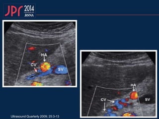 Ultrasound Quarterly 2009; 25:3-13
 