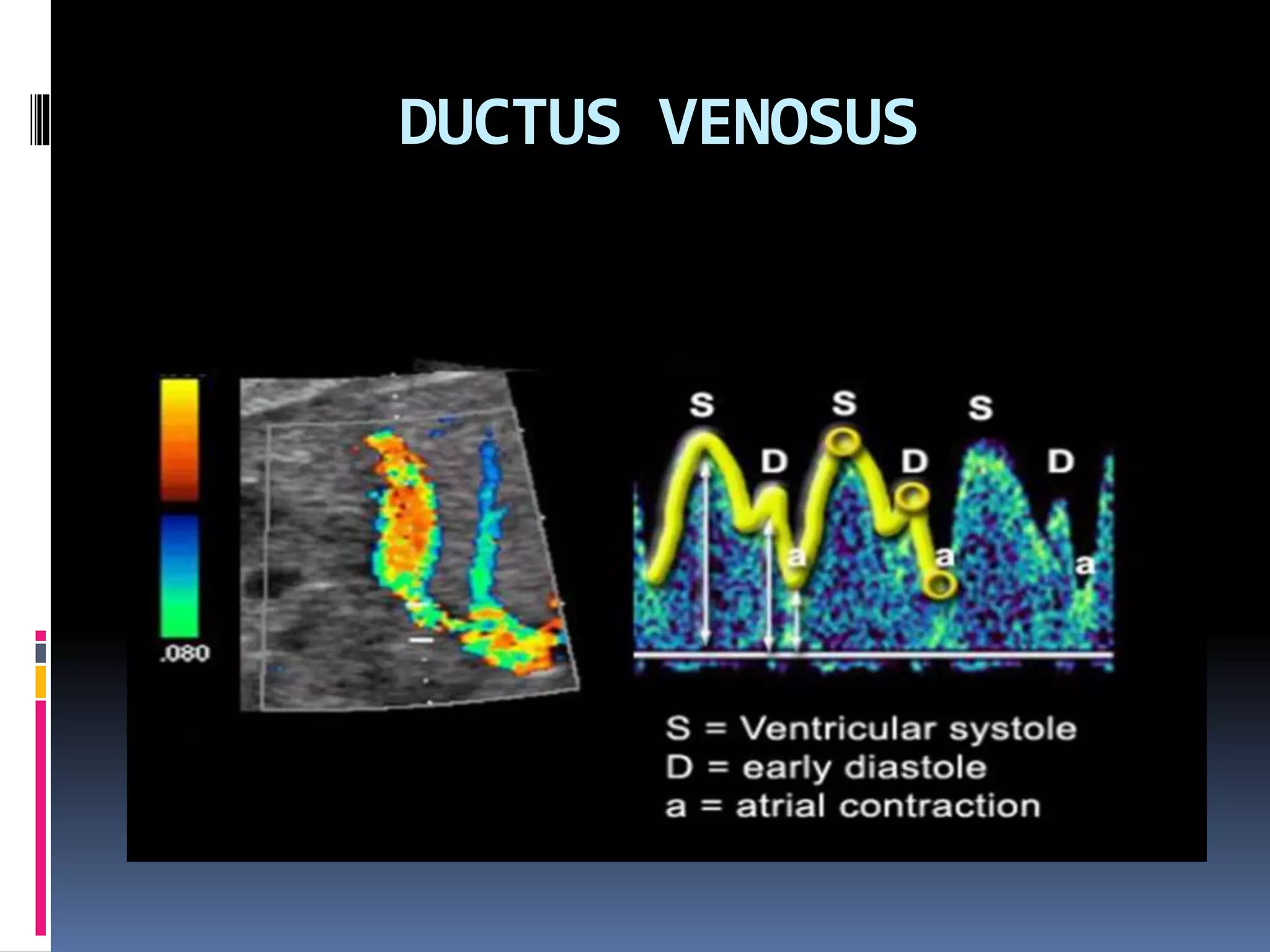 DUCTUS VENOSUS
 
