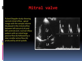 Mitral Inflow Letters Doppler in obstetric power point presentation (4) | PPTX