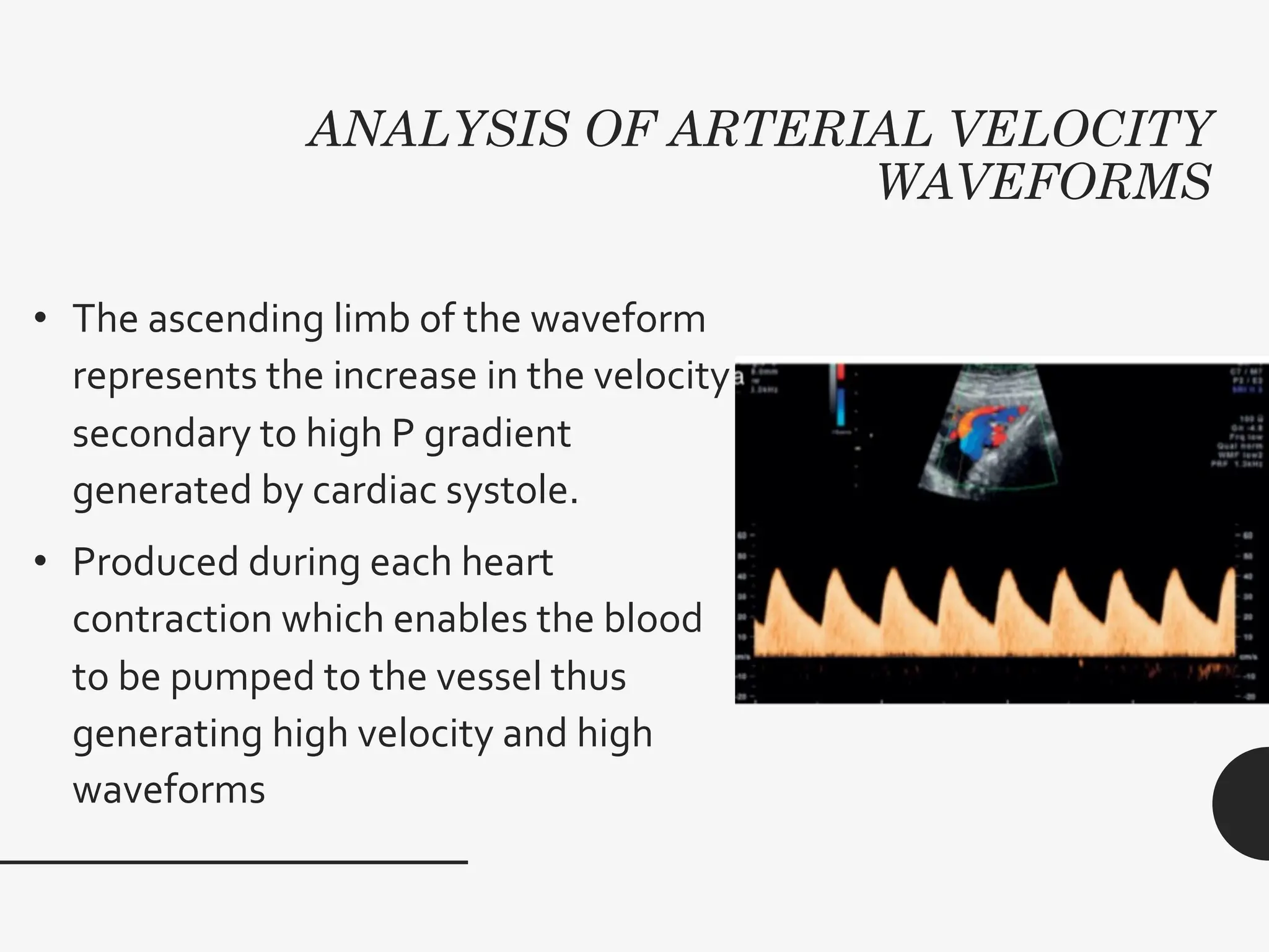 ANALYSIS OF ARTERIAL VELOCITY
WAVEFORMS
• The ascending limb of the waveform
represents the increase in the velocity
secondary to high P gradient
generated by cardiac systole.
• Produced during each heart
contraction which enables the blood
to be pumped to the vessel thus
generating high velocity and high
waveforms
 