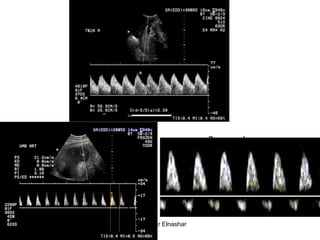 Normal
Absent
Reversed
Aboubakr Elnashar
 