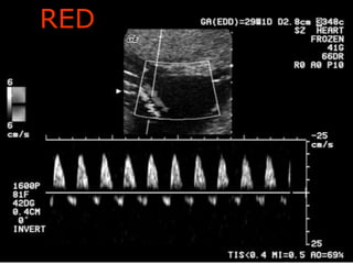RED
Aboubakr Elnashar
 