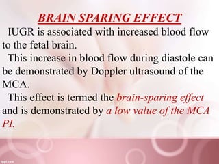 doppler lecture.pptx