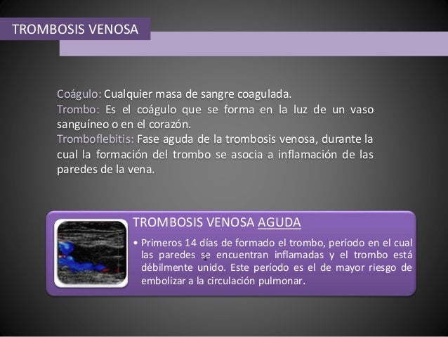 El pie se ha hinchado duele las venas