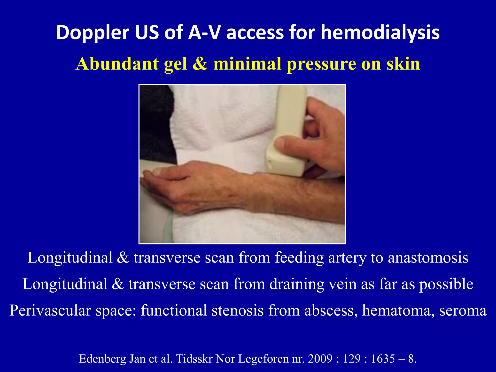 Doppler ultrasound of A-V access for hemodialysis | PPTX