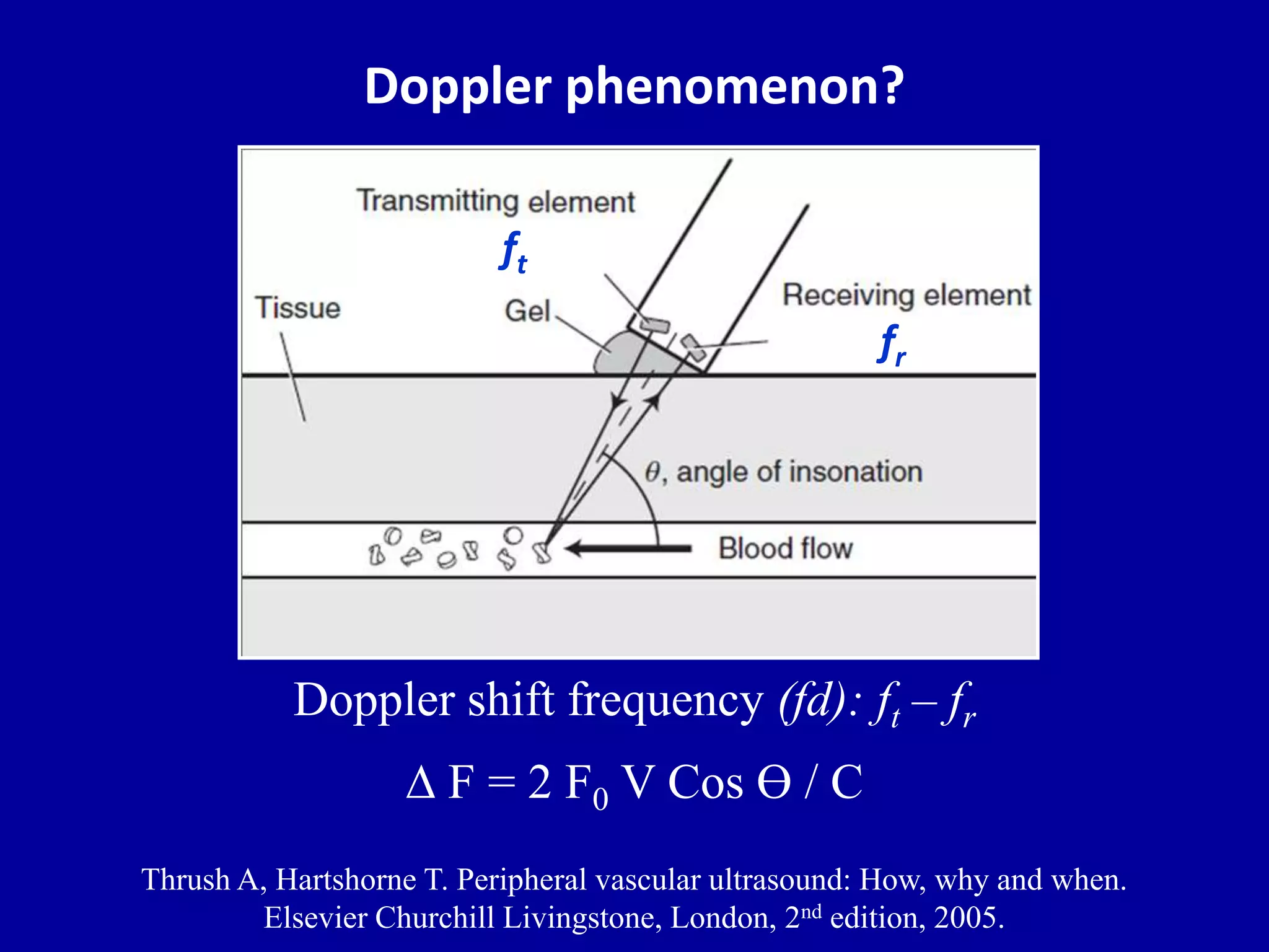 Doppler ultrasound of A-V access for hemodialysis | PPTX