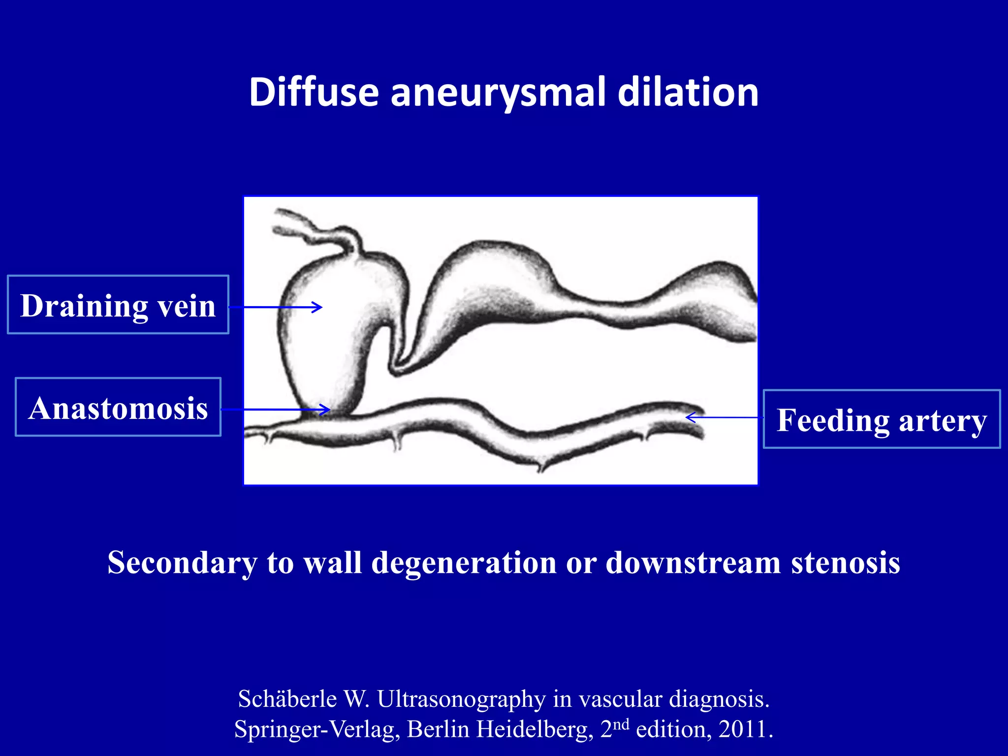 Doppler ultrasound of A-V access for hemodialysis | PPTX