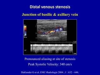 Doppler ultrasound of A-V access for hemodialysis | PPTX