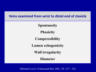 Spontaneity
Phasicity
Compressibility
Lumen echogenicity
Wall irregularity
Diameter
Veins examined from wrist to distal end of clavicle
Mihmanli I et al. J Ultrasound Med 2001 ; 20 : 217 – 222.
 