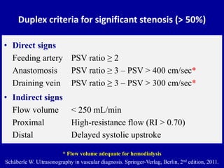 Duplex criteria for significant stenosis (> 50%)
• Direct signs
Feeding artery PSV ratio ≥ 2
Anastomosis PSV ratio ≥ 3 – P...