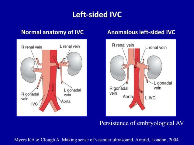 Doppler ultrasound of the portal system - Normal findings | PPTX