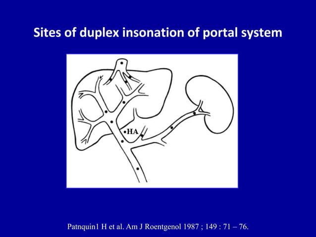 Doppler ultrasound of the portal system - Normal findings | PPTX