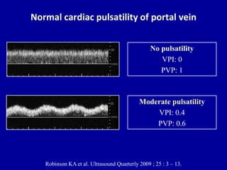 Portal Pattern Normal Doppler ultrasound of the portal system - Normal findings | PPTX