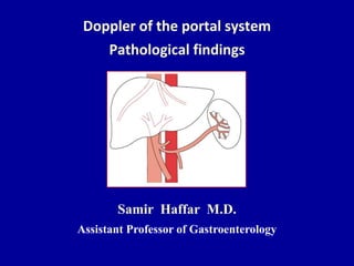 Doppler of the portal system
Pathological findings
Samir Haffar M.D.
Assistant Professor of Gastroenterology
 