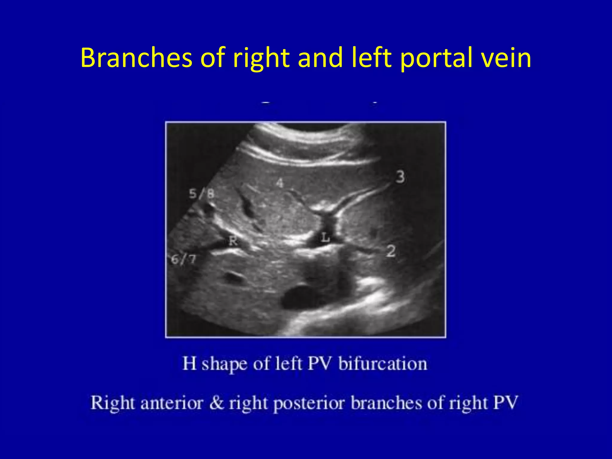 Branches of right and left portal vein
 