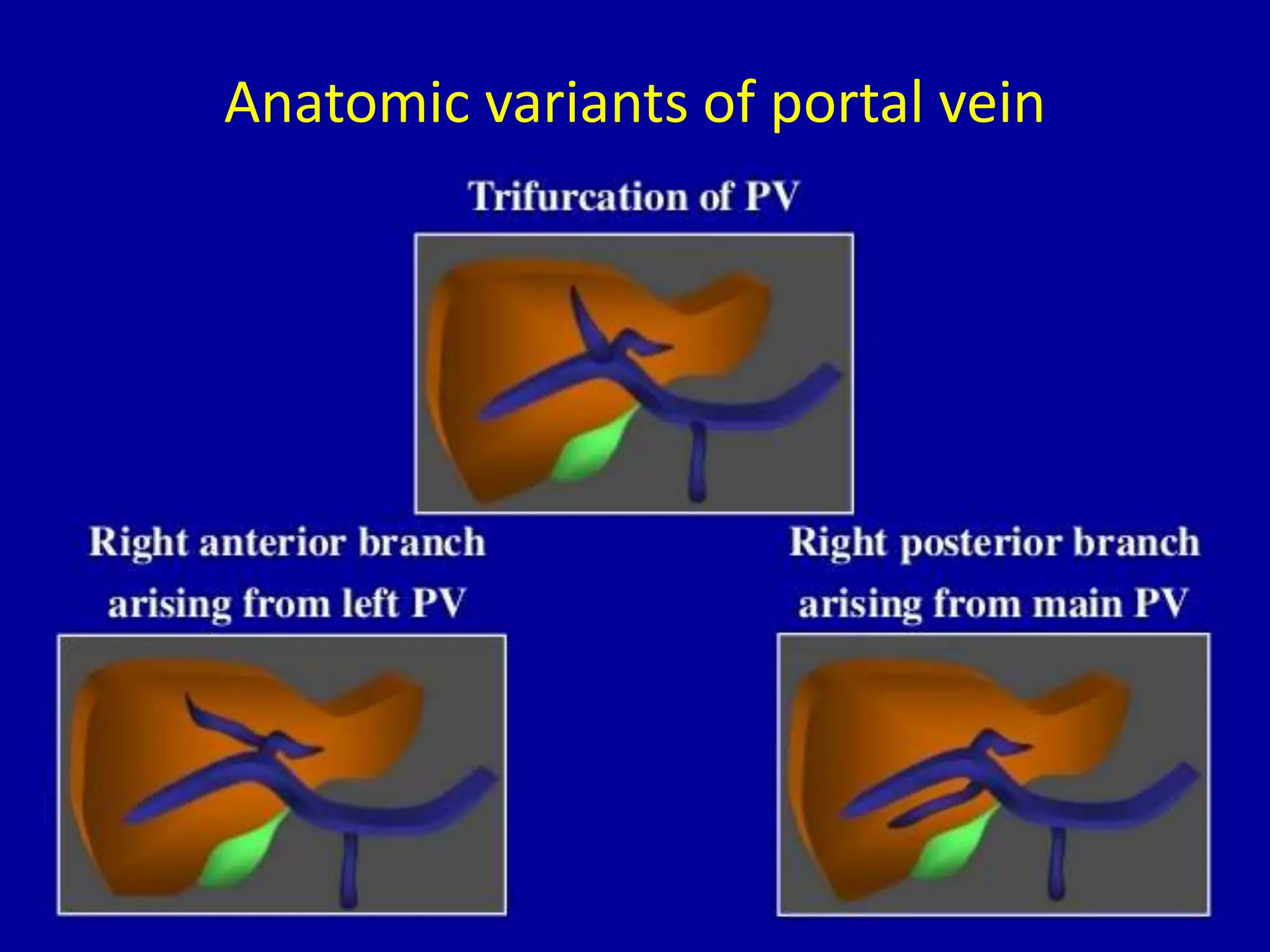 Anatomic variants of portal vein
 