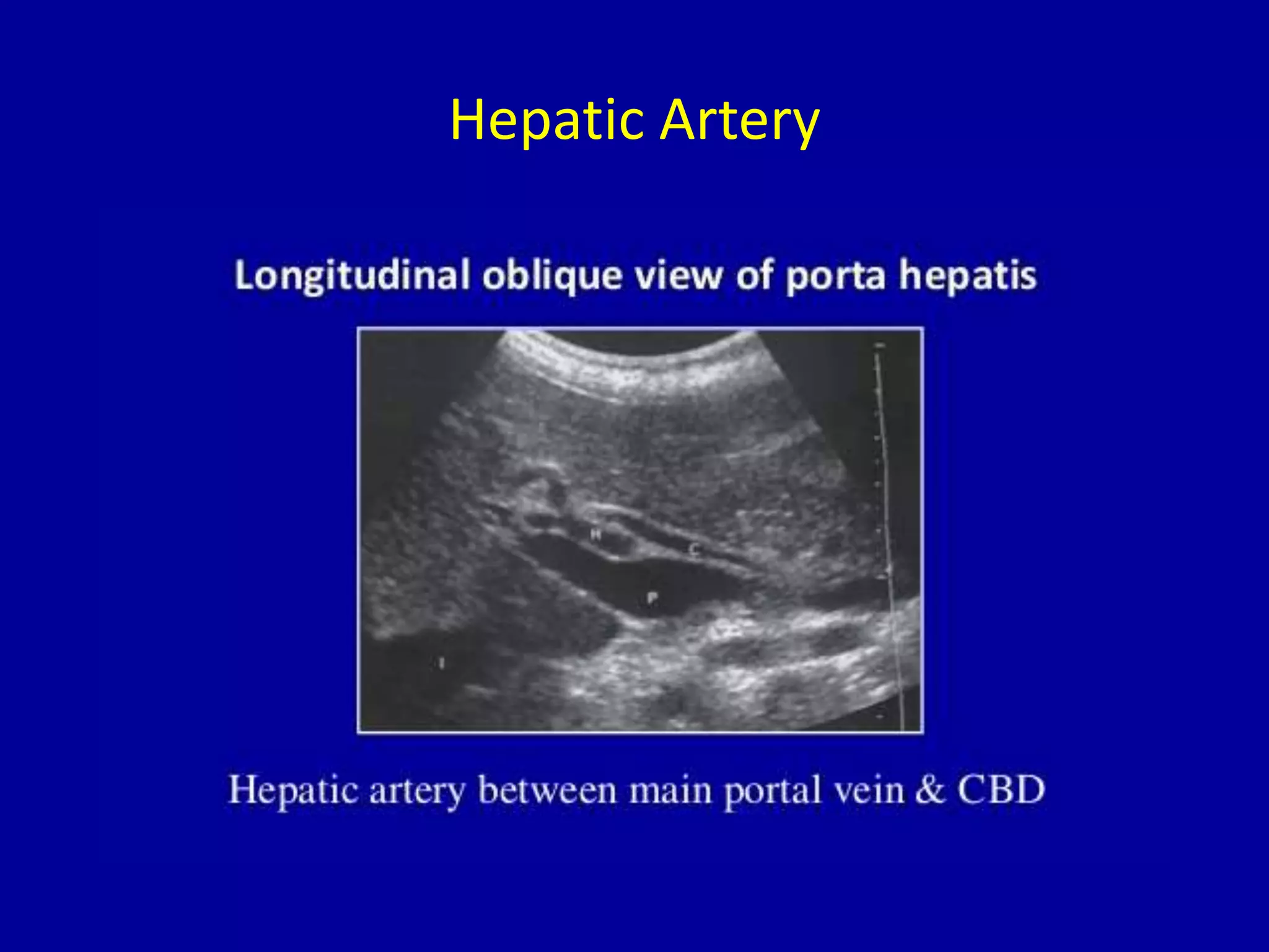 Hepatic Artery
 