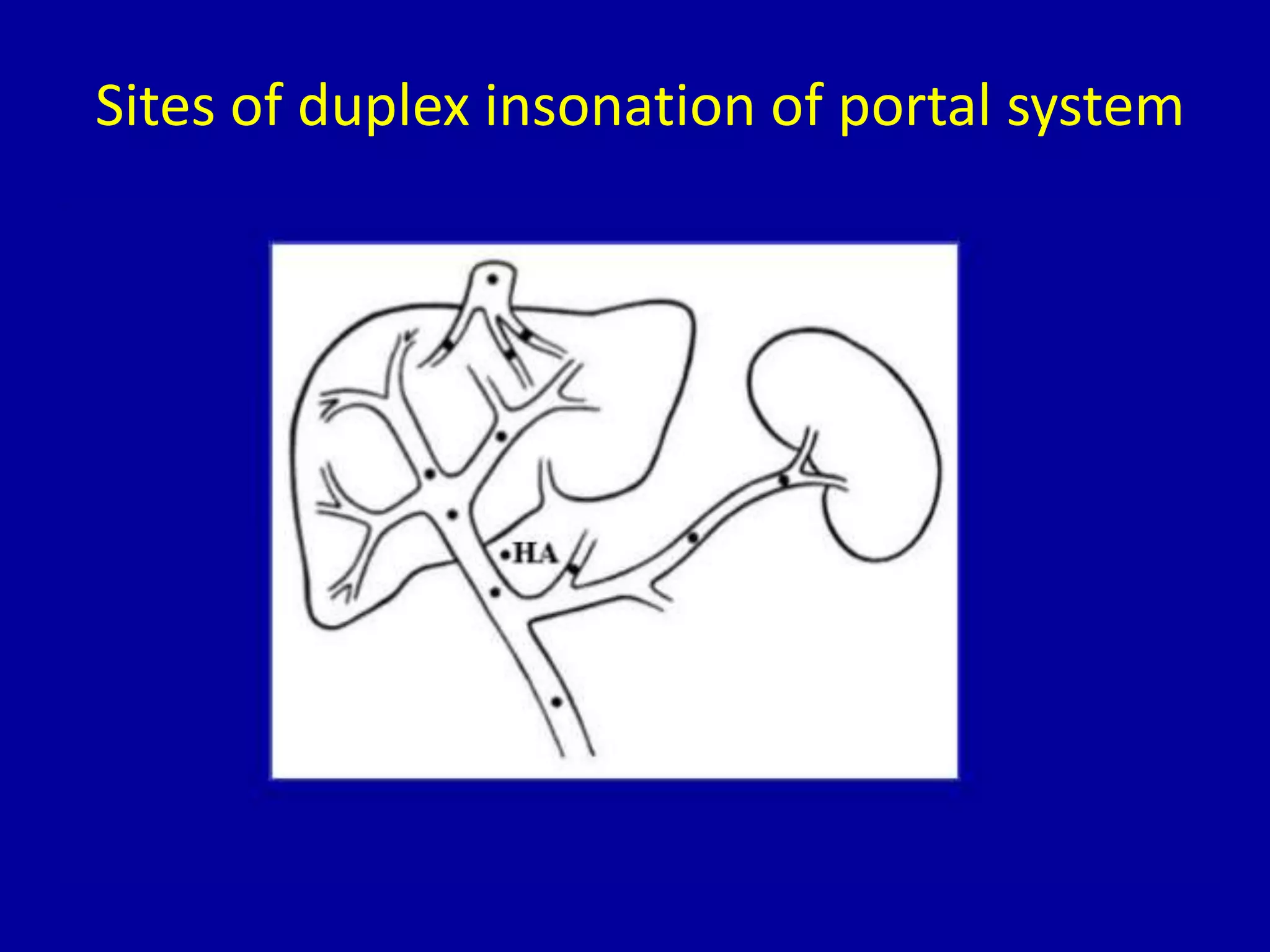 Sites of duplex insonation of portal system
 
