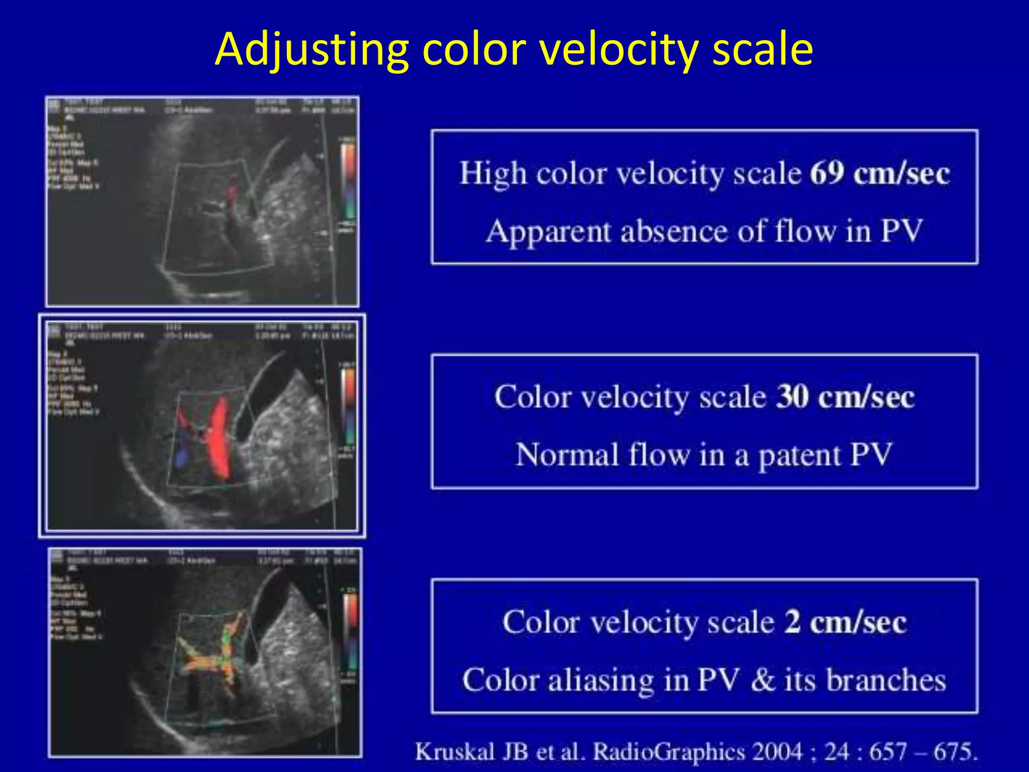 Adjusting color velocity scale
 