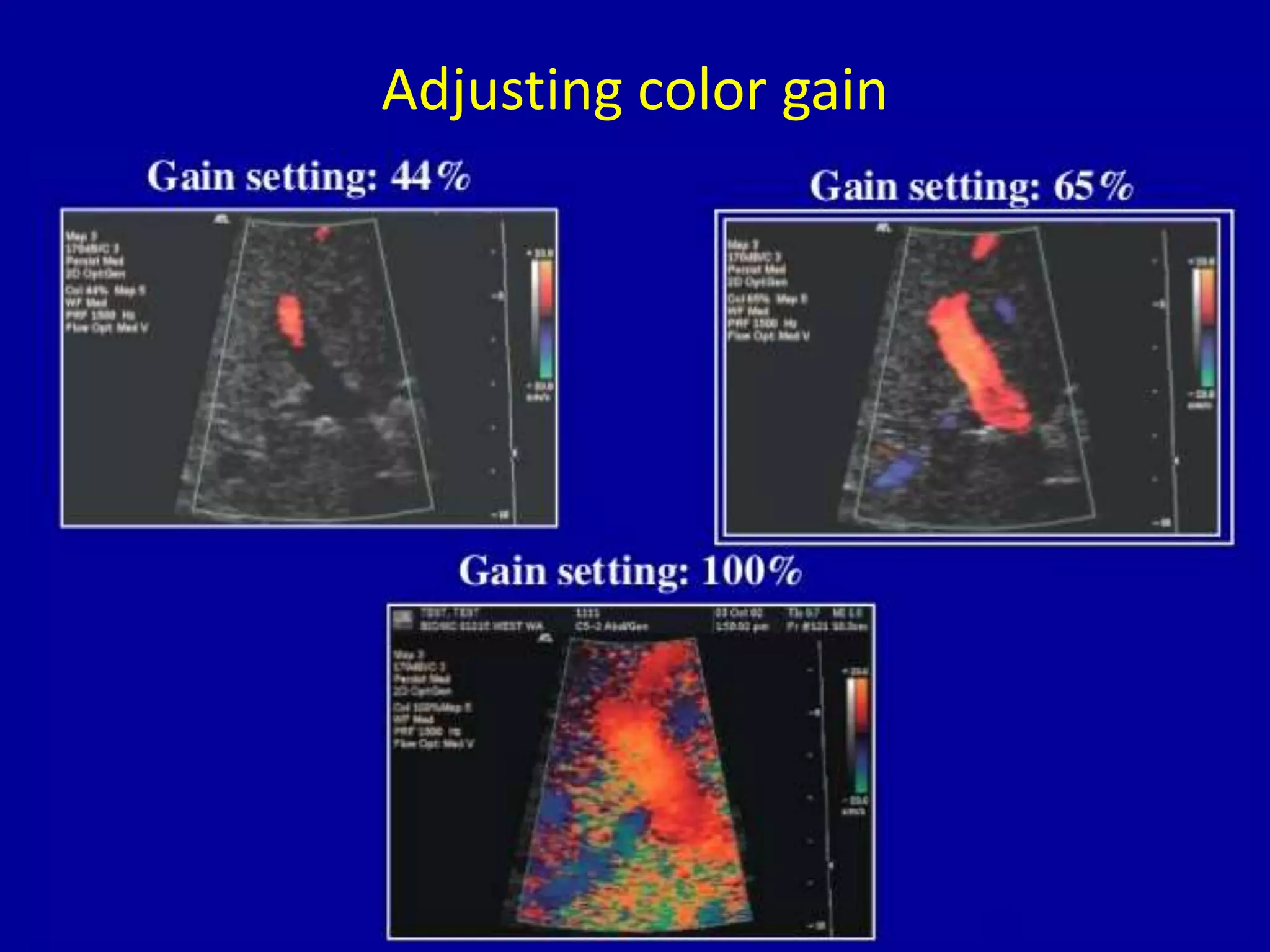 Adjusting color gain
 