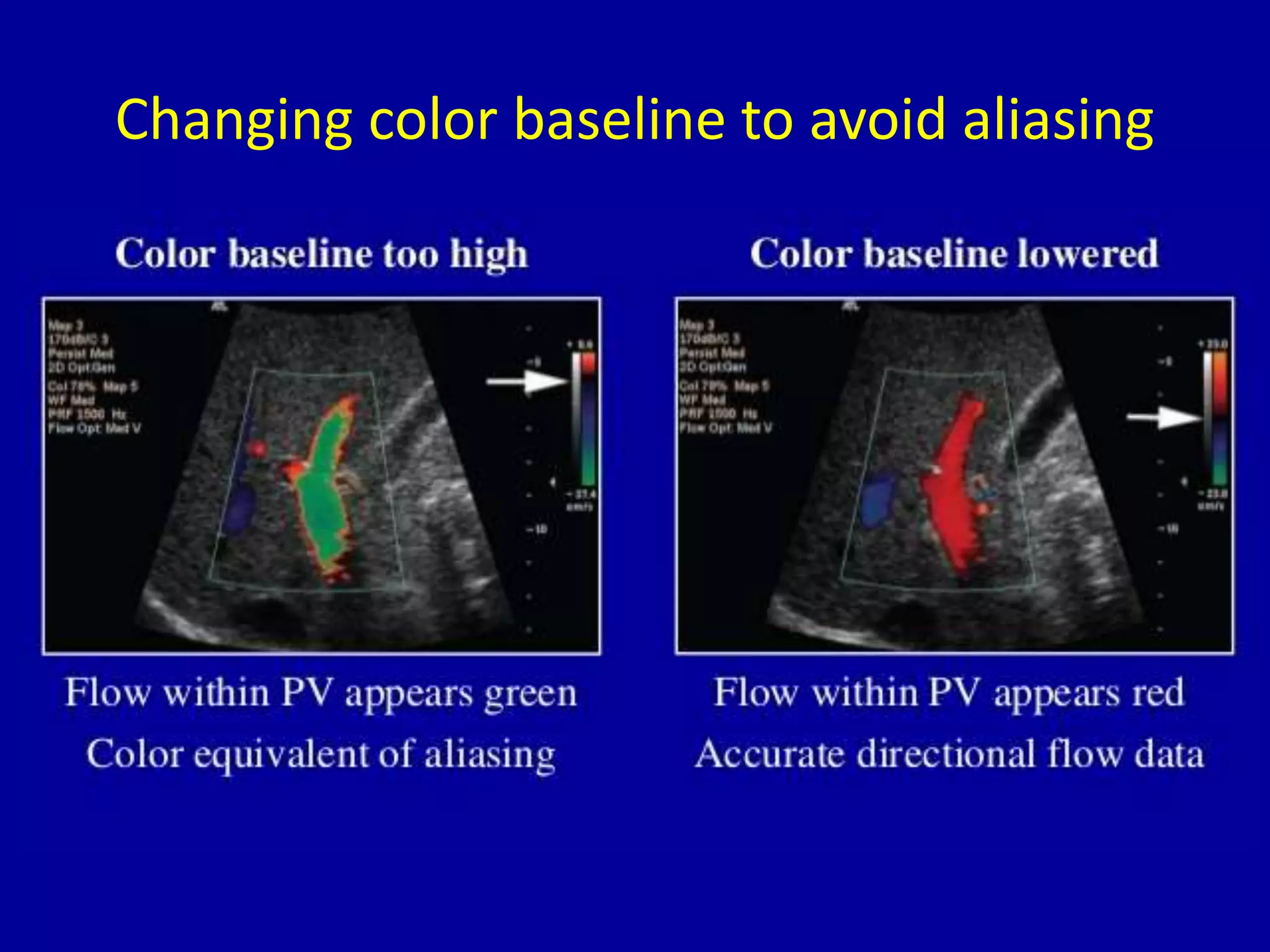 Changing color baseline to avoid aliasing
 