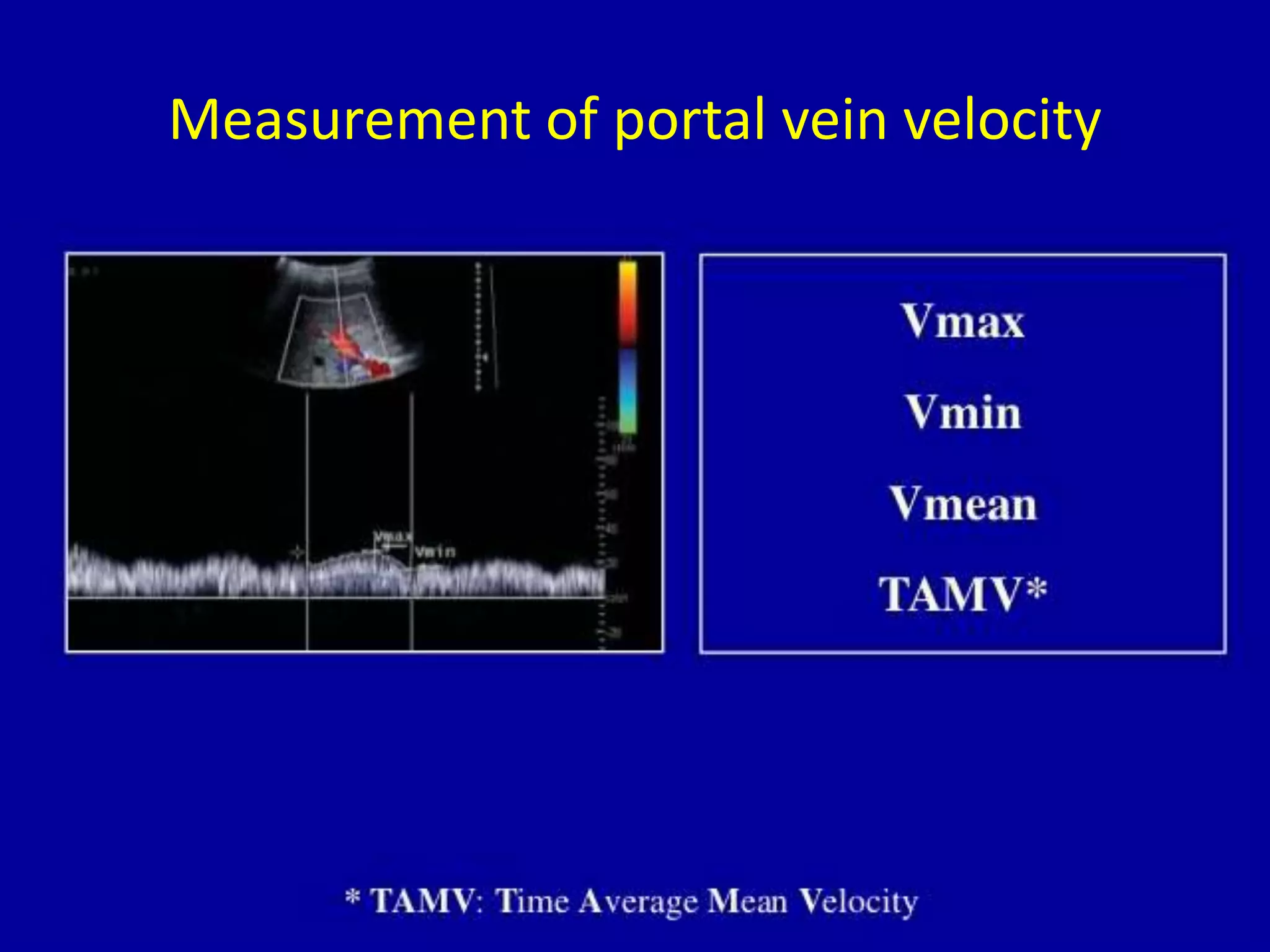 Measurement of portal vein velocity
 