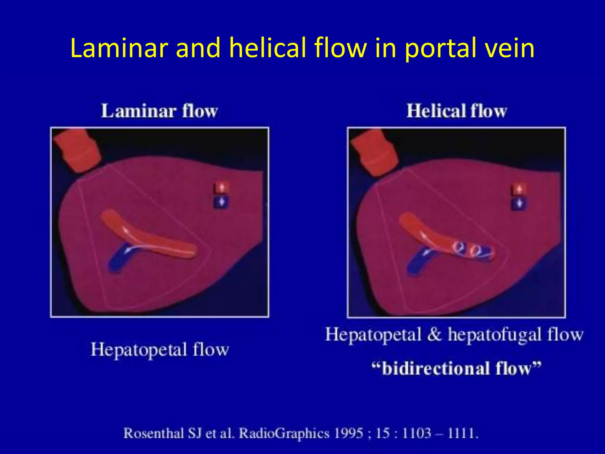 Laminar and helical flow in portal vein
 