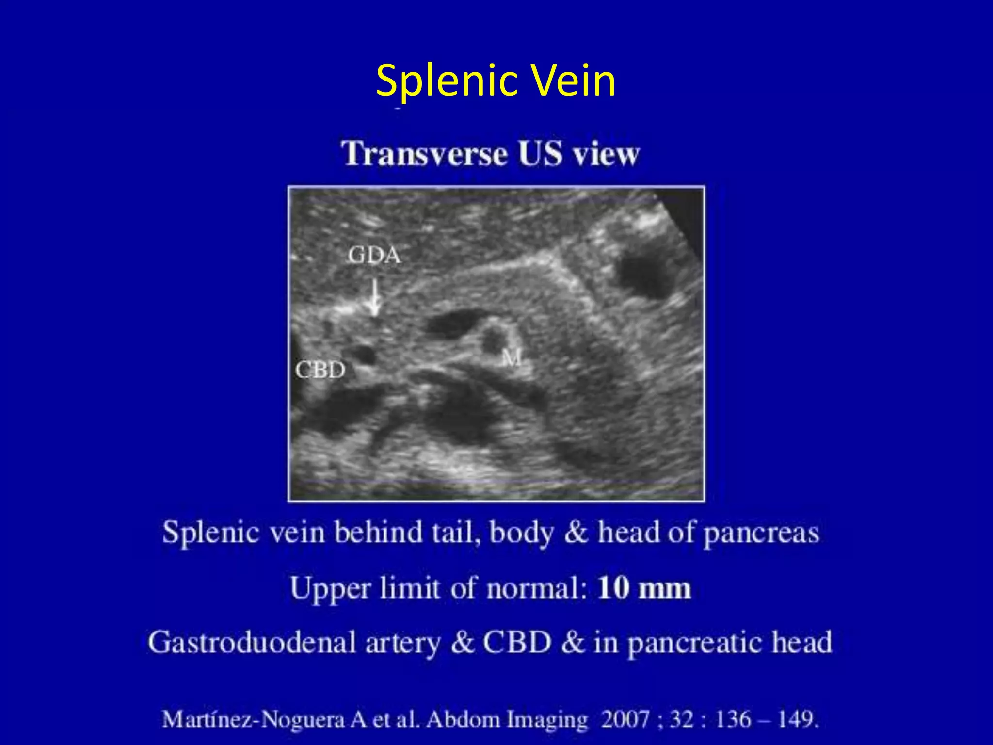 Splenic Vein
 