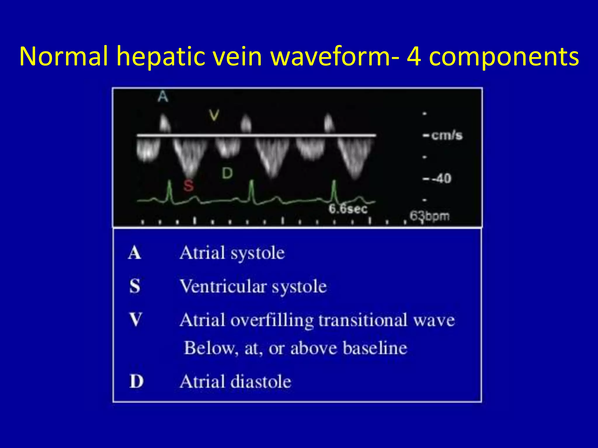 Normal hepatic vein waveform- 4 components
 