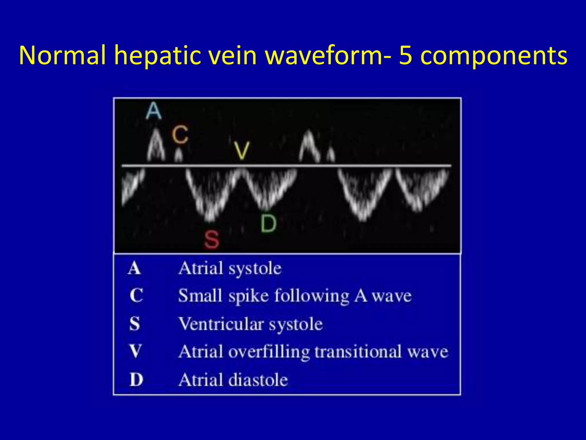 Normal hepatic vein waveform- 5 components
 