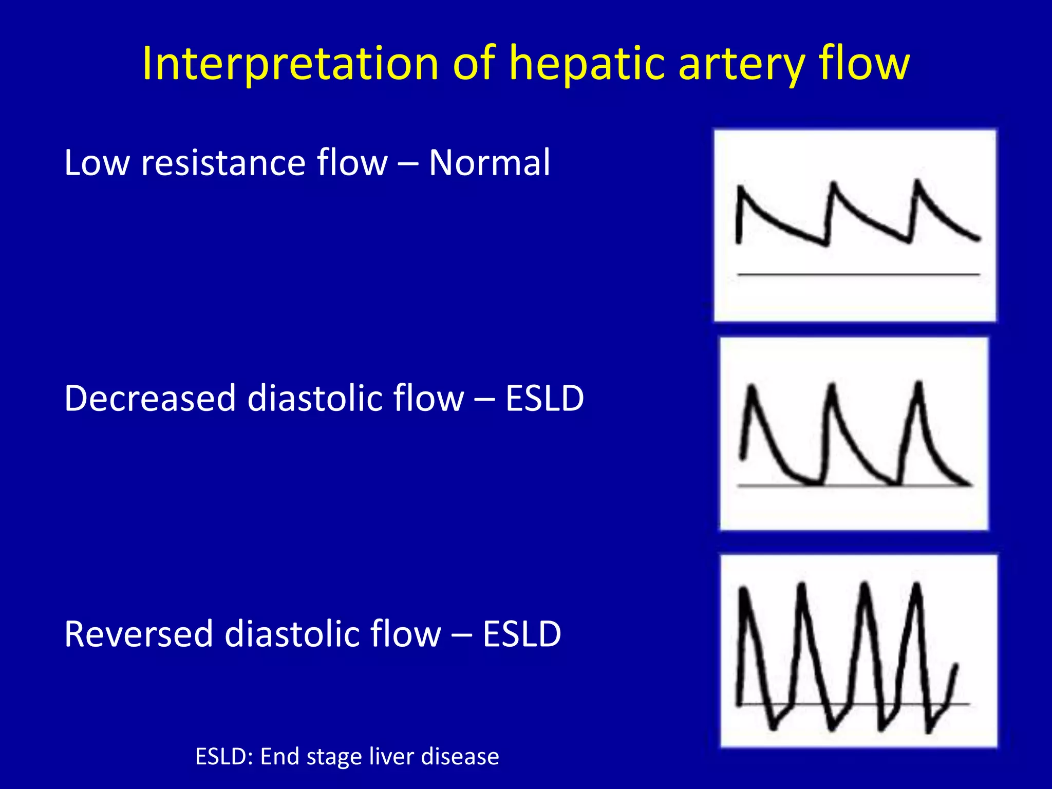 Interpretation of hepatic artery flow
Low resistance flow – Normal
Decreased diastolic flow – ESLD
Reversed diastolic flow – ESLD
ESLD: End stage liver disease
 