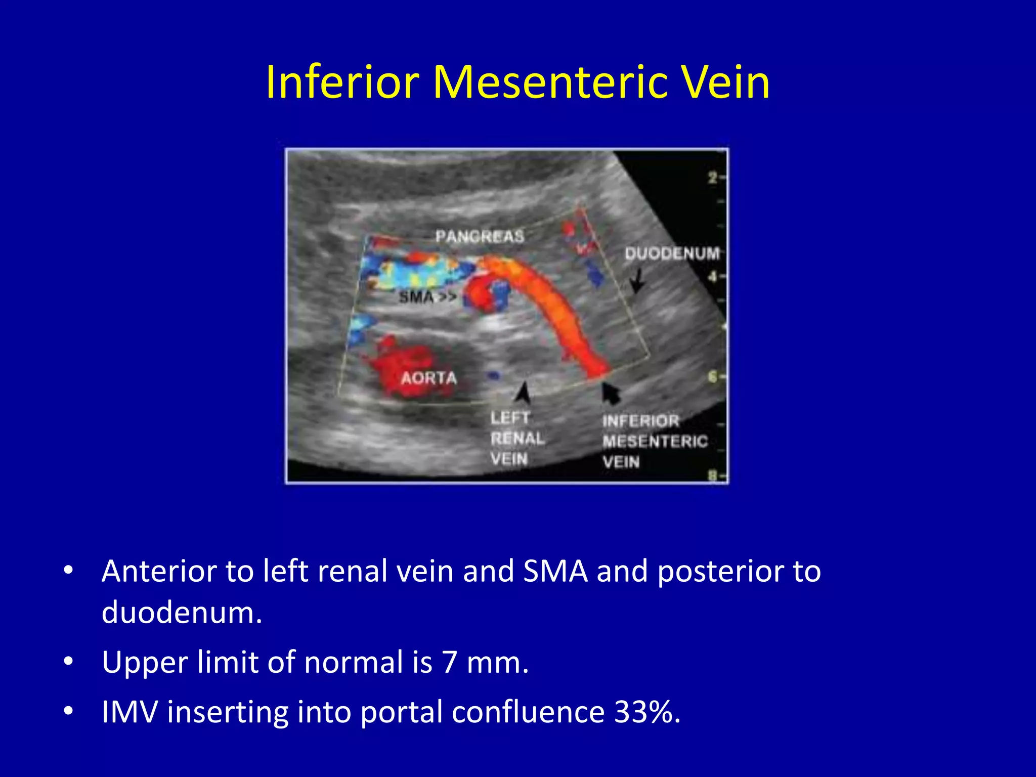 Inferior Mesenteric Vein
• Anterior to left renal vein and SMA and posterior to
duodenum.
• Upper limit of normal is 7 mm.
• IMV inserting into portal confluence 33%.
 