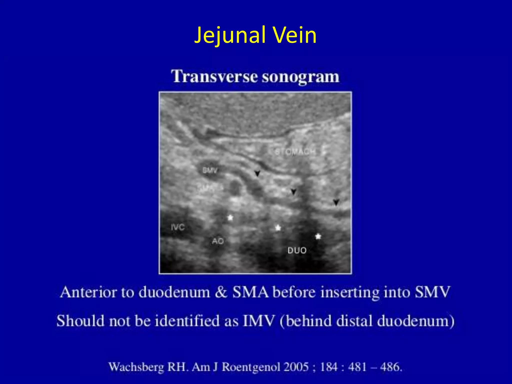 Jejunal Vein
 