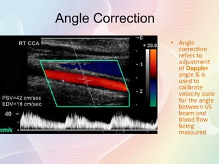 Doppler Physics | PDF