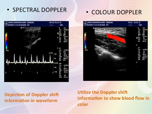 Doppler Physics