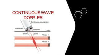 Doppler physics.pptx