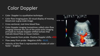 Doppler Color Pages Doppler physics.pptx