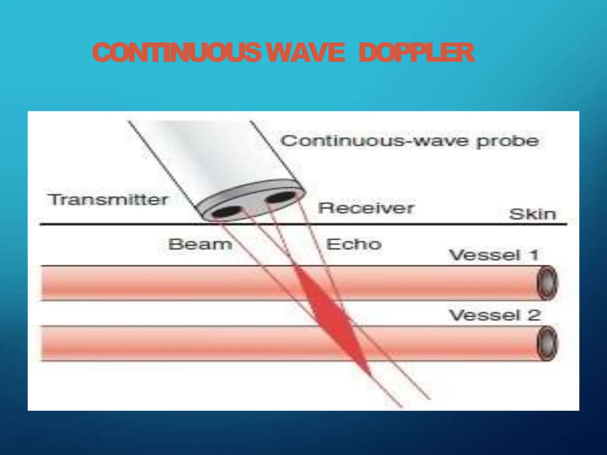 CONTINUOUSWAVE DOPPLER
 
