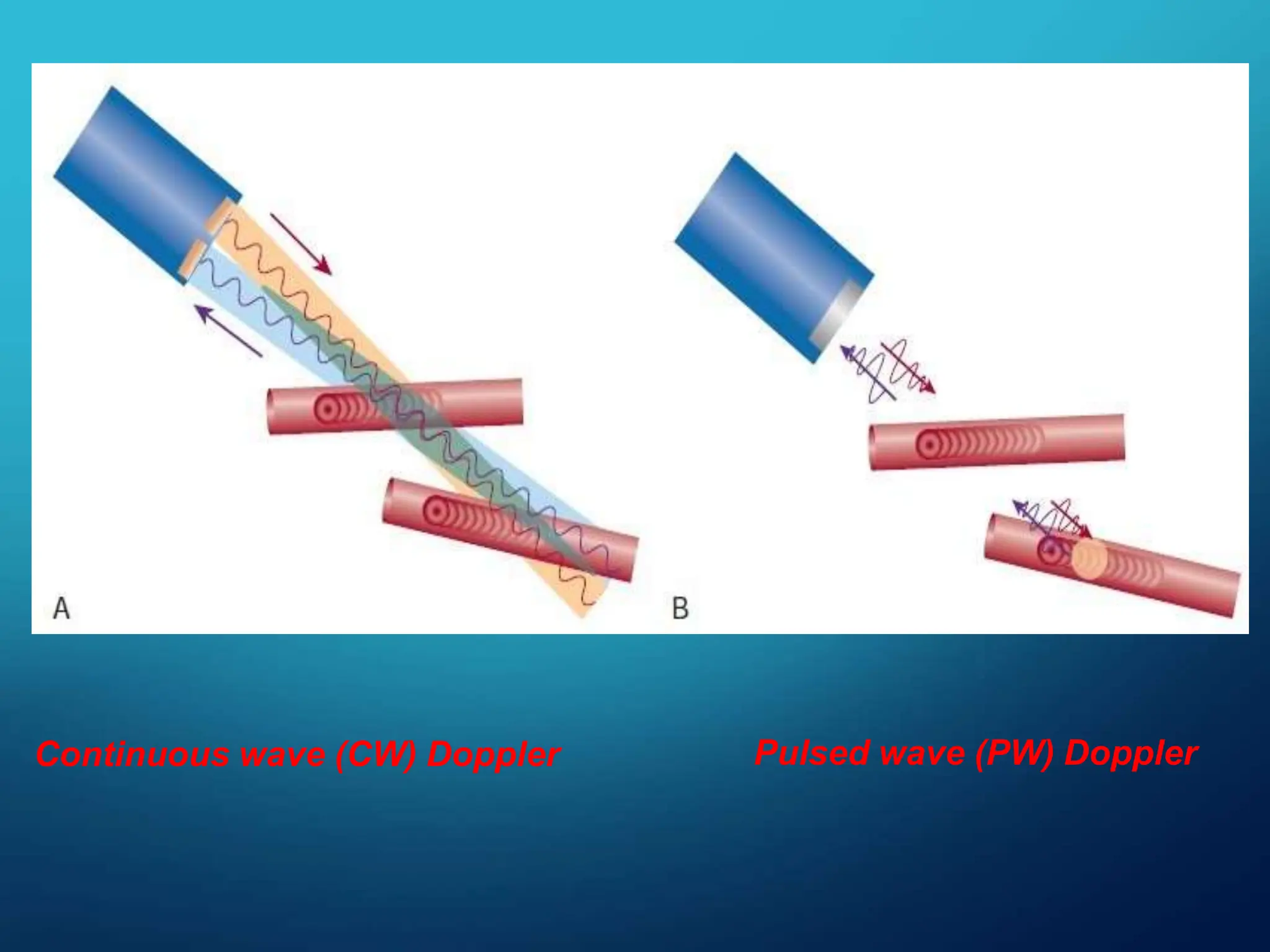 Continuous wave (CW) Doppler Pulsed wave (PW) Doppler
 