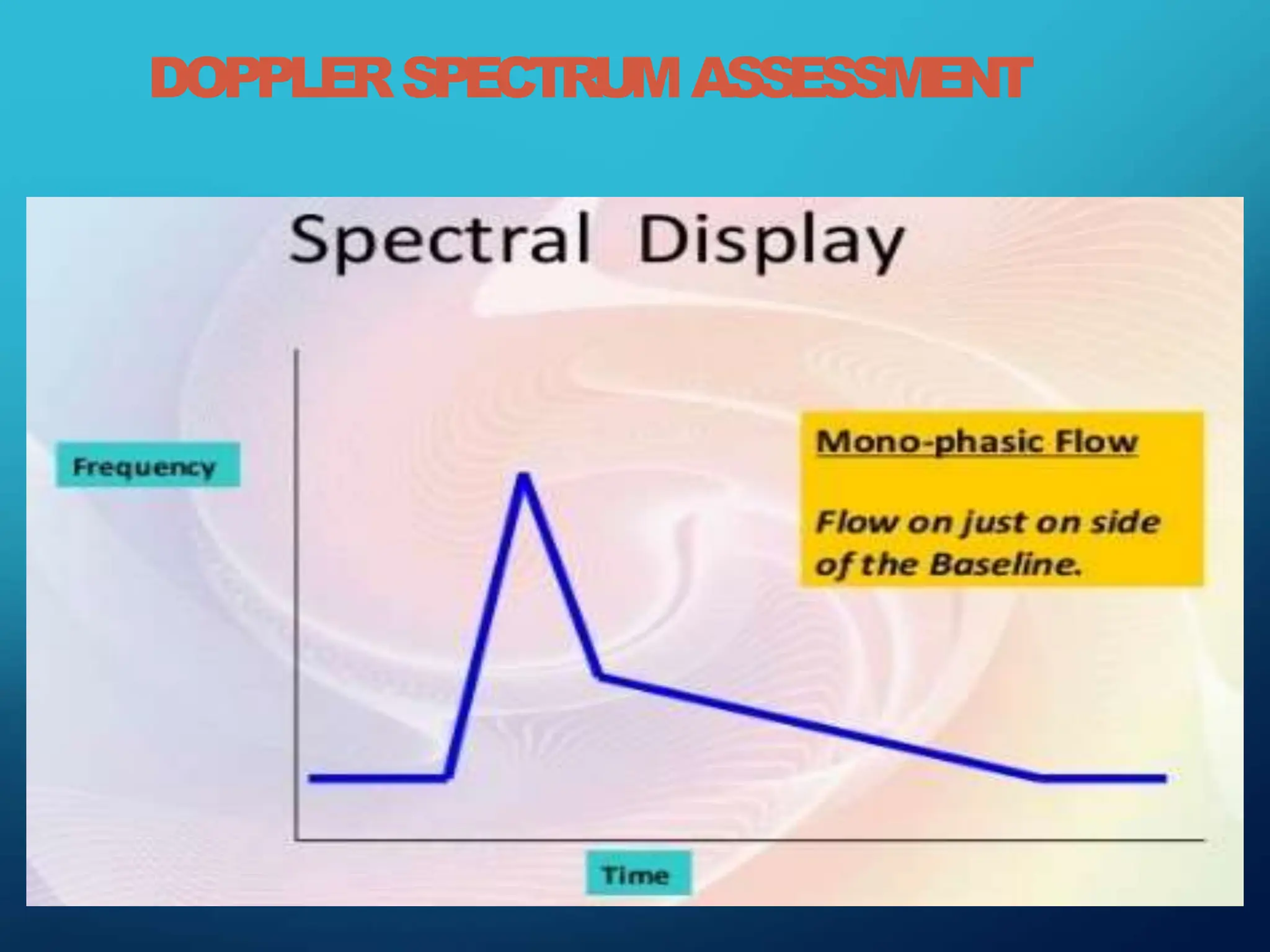 DOPPLERSPECTRUMASSESSMENT
 