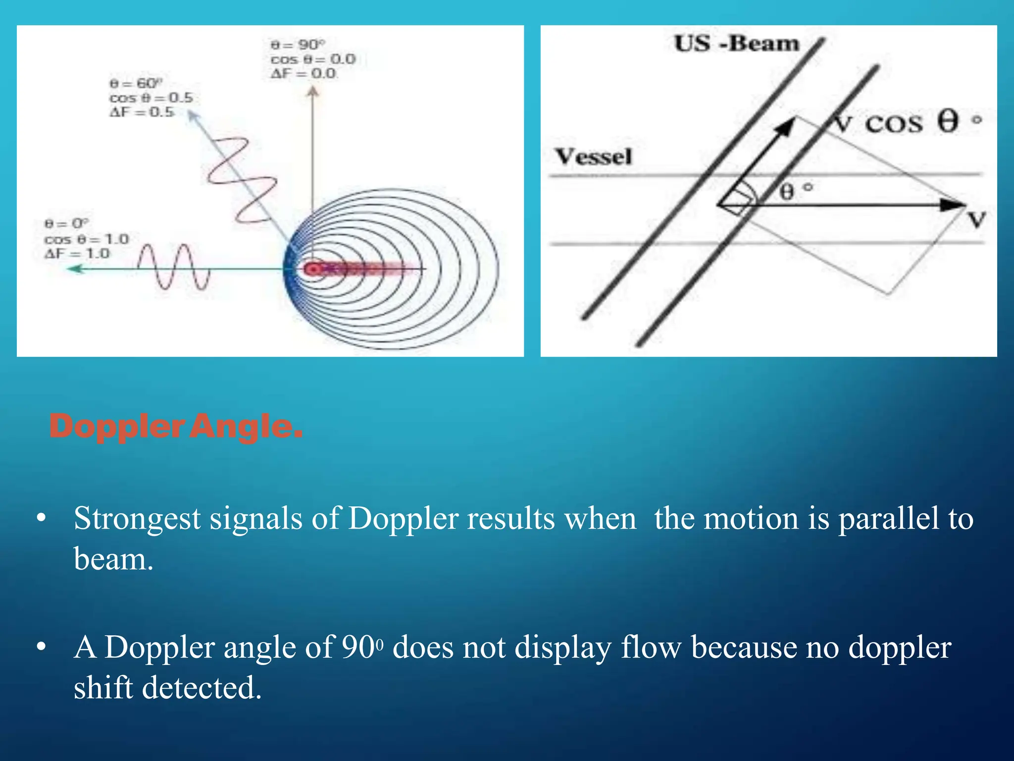 DopplerAngle.
• Strongest signals of Doppler results when the motion is parallel to
beam.
• A Doppler angle of 900 does not display flow because no doppler
shift detected.
 