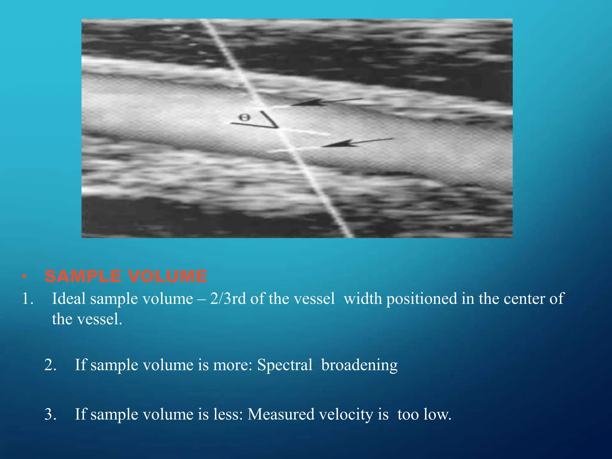 • SAMPLE VOLUME
1. Ideal sample volume – 2/3rd of the vessel width positioned in the center of
the vessel.
2. If sample volume is more: Spectral broadening
3. If sample volume is less: Measured velocity is too low.
 