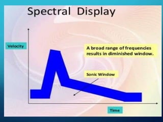 Exploring Doppler Effect Physics: Frequency Shifts in Sound and Light ...