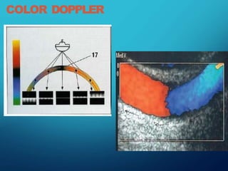 Exploring Doppler Effect Physics: Frequency Shifts in Sound and Light ...