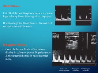 Exploring Doppler Effect Physics: Frequency Shifts in Sound and Light ...