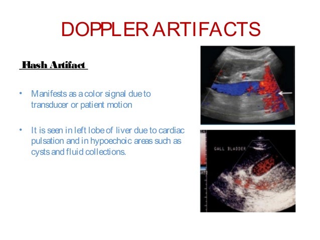 Doppler Teaching Manual Doppler Teaching Manual