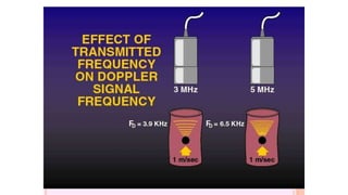 F
2fo vcosθ
D 
c
13
 