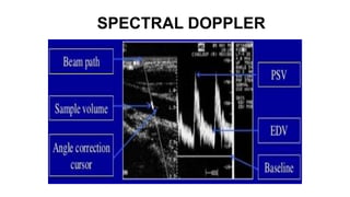SPECTRAL DOPPLER
 