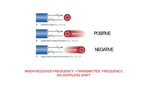 POSITIVE
NEGATIVE
WHEN RECEIVED FREQUENCY =TRANSMITTED FREQUENCY,
NO DOPPLERS SHIFT
 